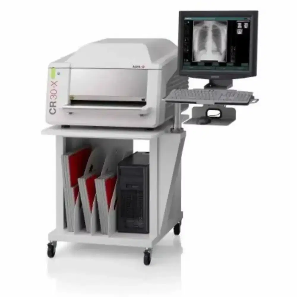 CR 30X Agfa Second running well