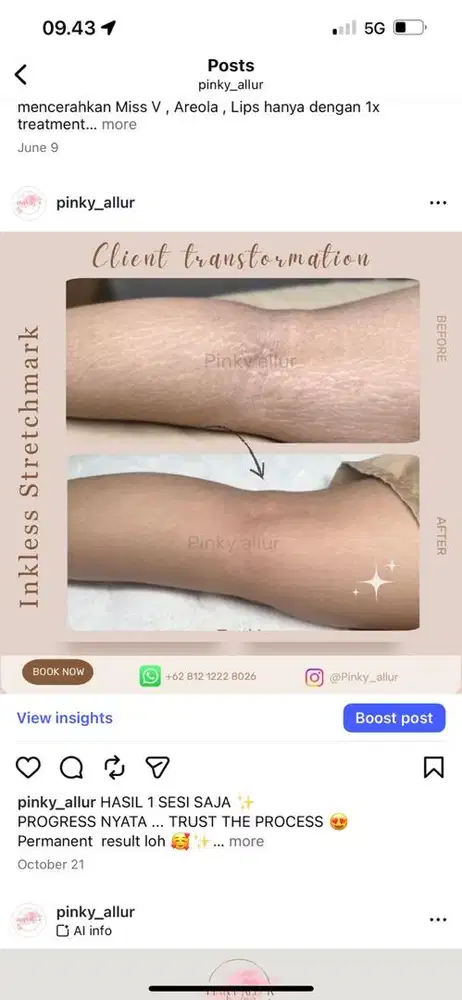 Di butuhkan jasa untuk model estetik