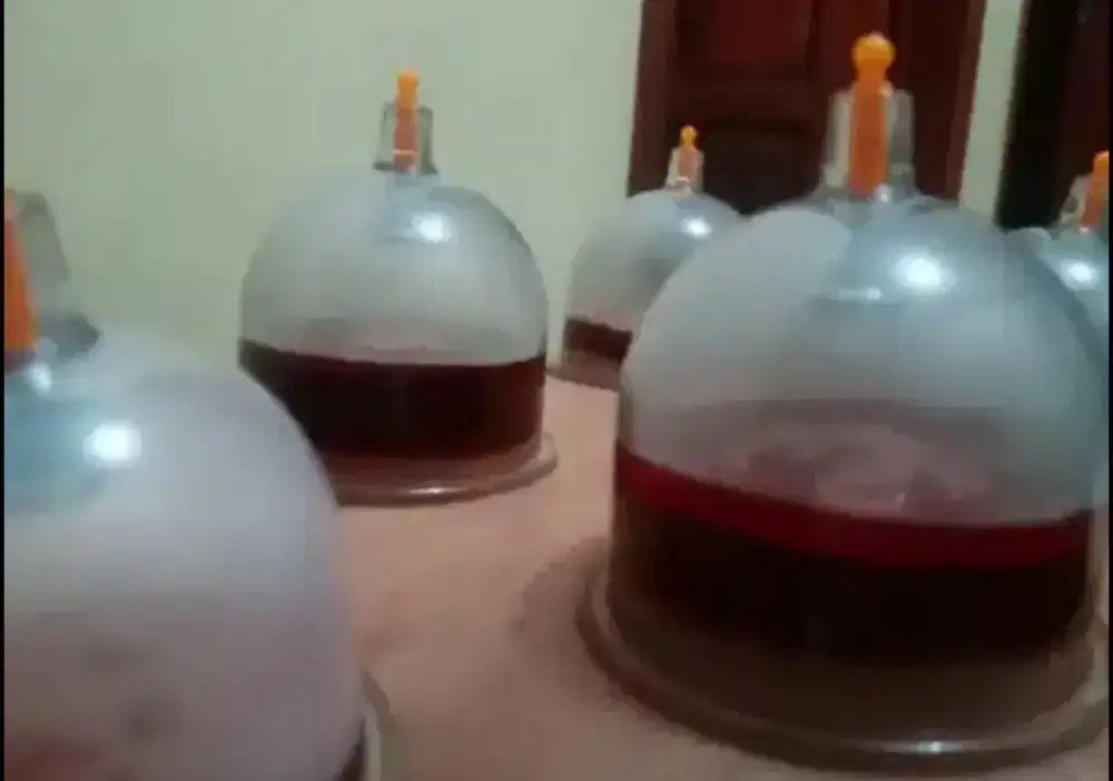 Jasa Bekam Panggilan PRIA Full Body