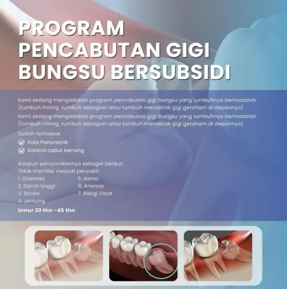 Pencabutan gigi bungsu bersubsidi