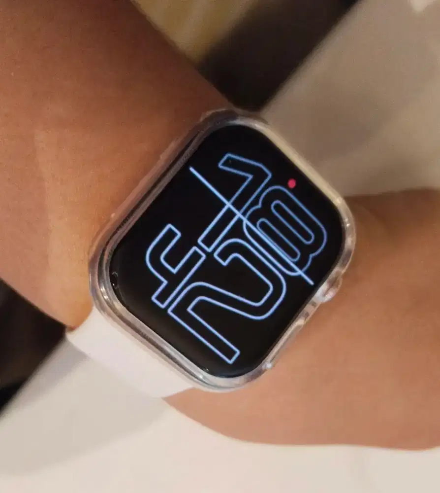 I watch seri 10 like new