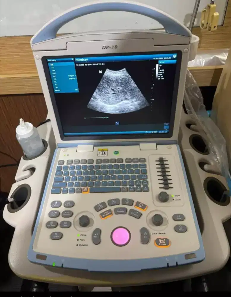 USG mindray DP 10 tahun 2017