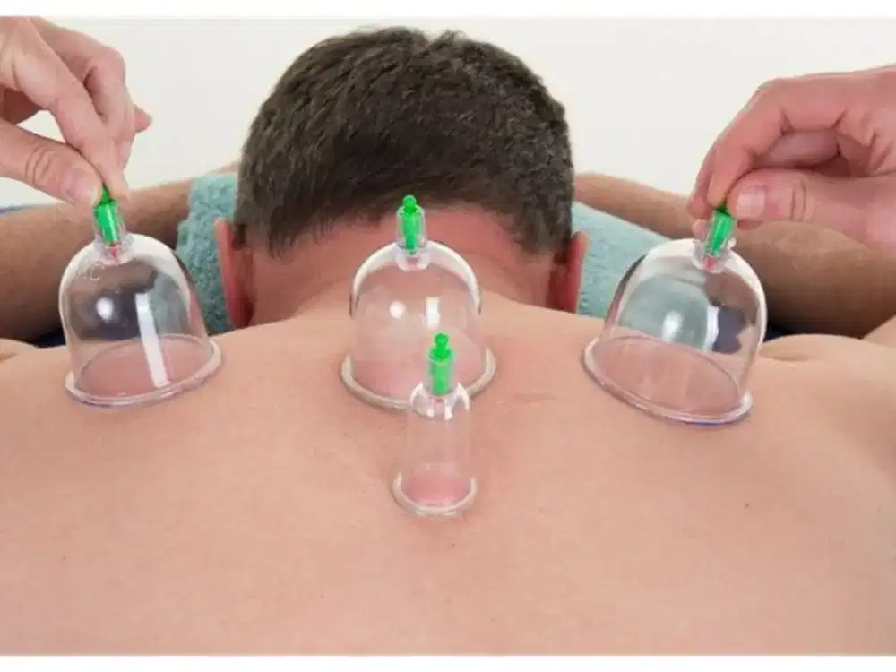 Bekam Tradisional Panggilan