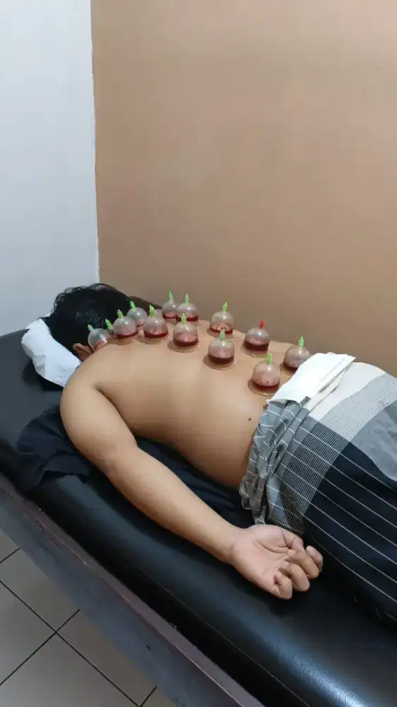 Jasa panggilan totok punggung, bekam, terapi lintah, dll