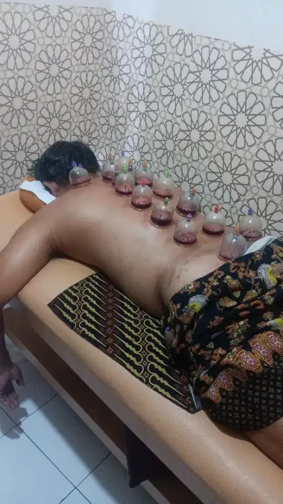 HOME SERVICE UNTUK TOTOK PUNGGUNG, BEKAM, TERAPI LINTAH, DLL