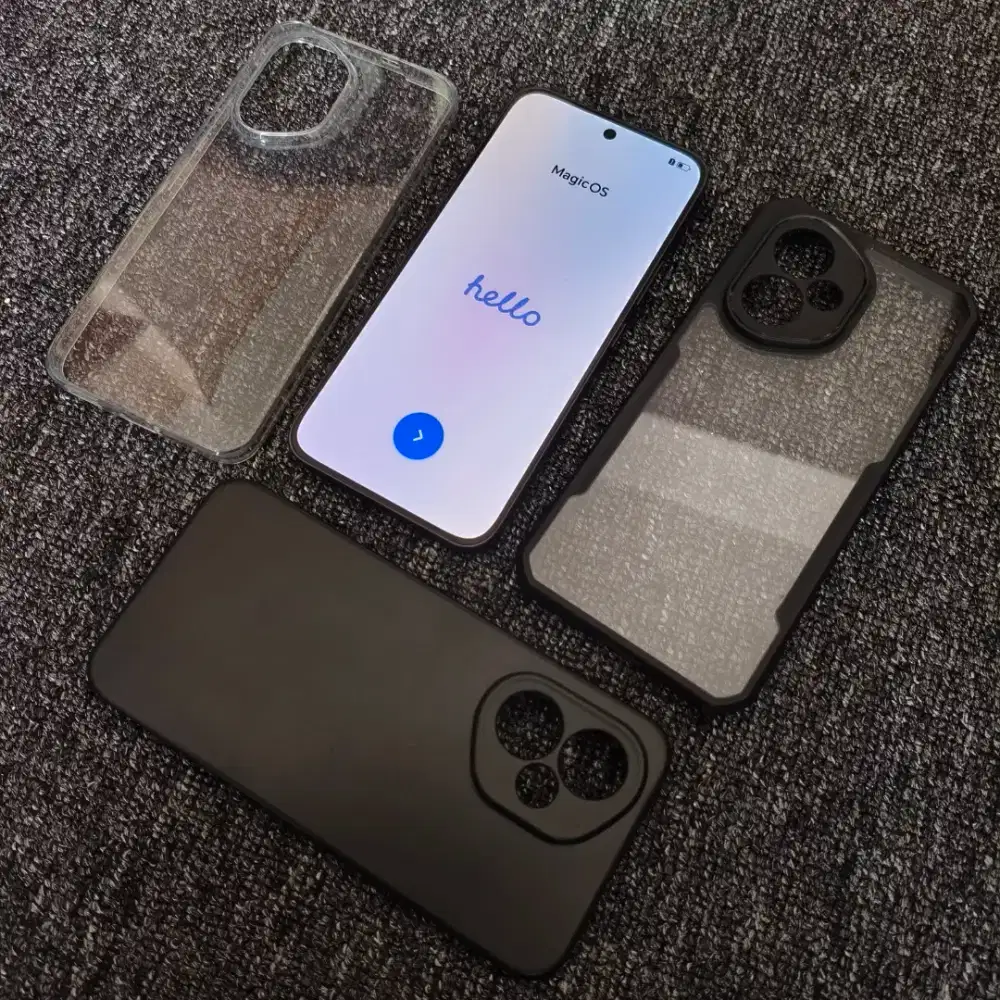 Honor 400 12/512 | Rasa Baru | AI Camera Canggih | Bonus Casing Xund