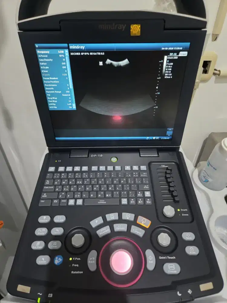 USG Mindray Digital Ultrasonic Doagnostic Imaging System DP 10 + Probe