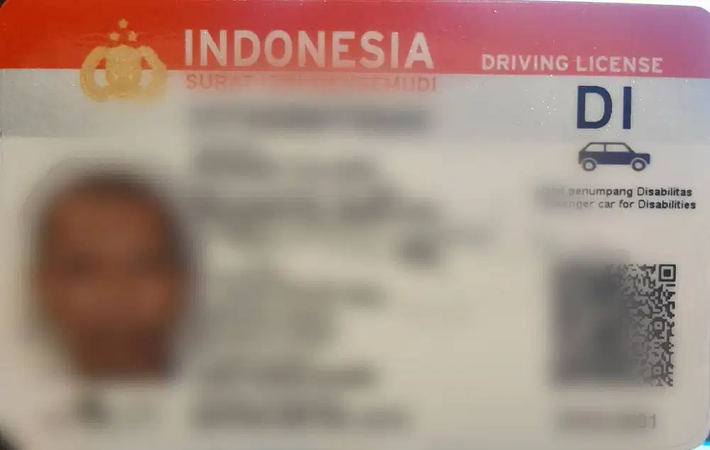 Amputee Kaki Mencari Pekerjaan Sebagai Driver Mobil Automatic