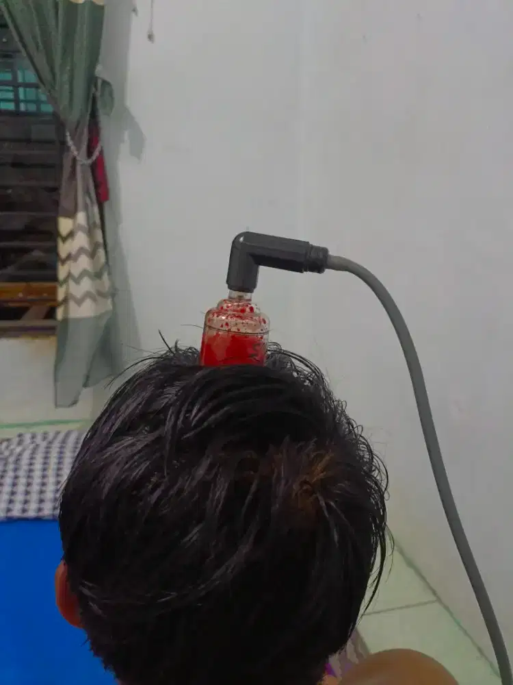 Terapi Bekam+infrared Panggilan
