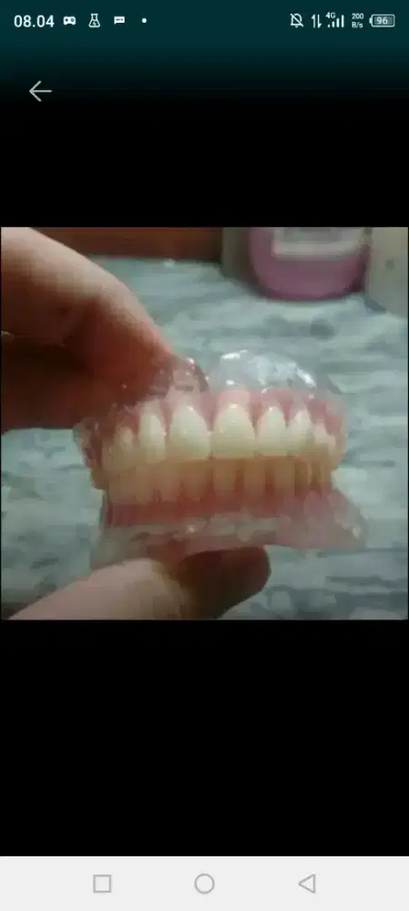 Pasang gigi terbaik