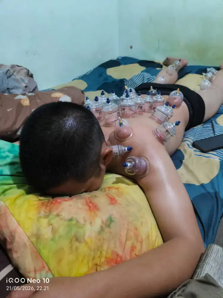 terapi pengobatan bekam