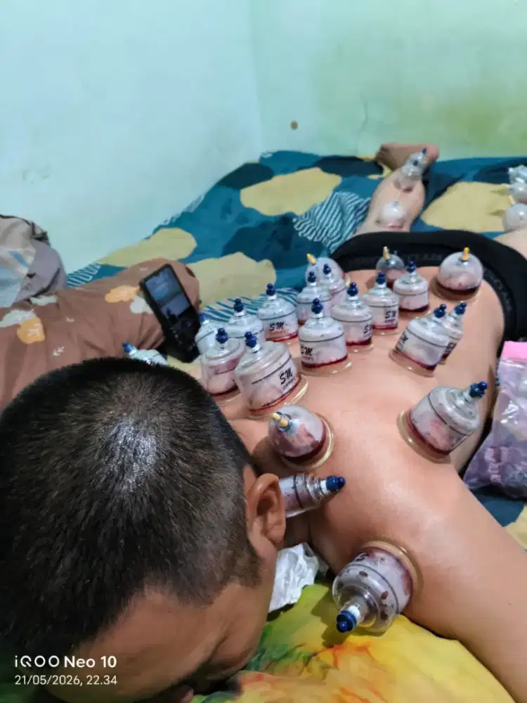 bekam dn pijat pangilan