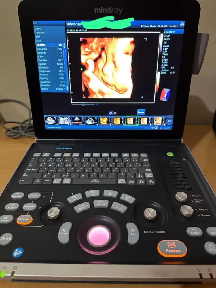 Mindray Z60 Second 4D With 3 Probe