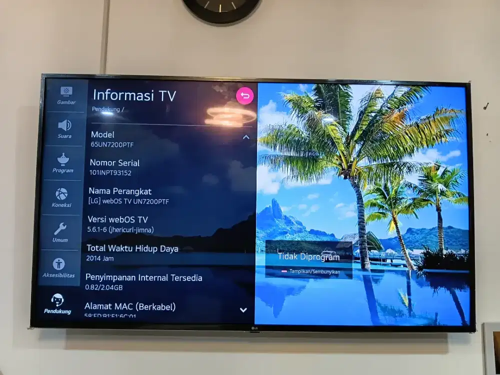 Android TV LG 65 inci