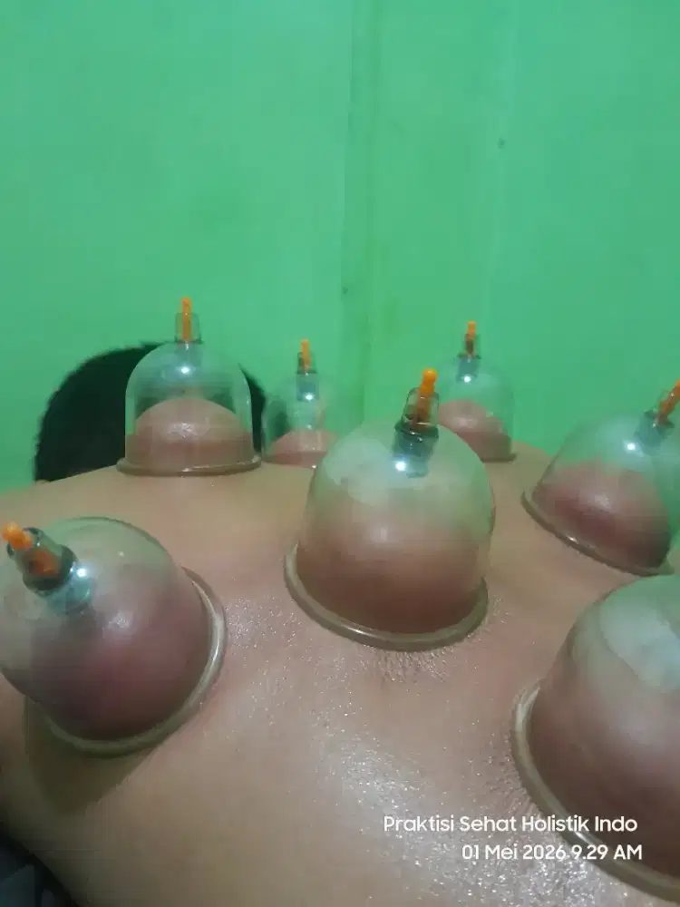 Jasa Bekam dan totok punggung, panggilan