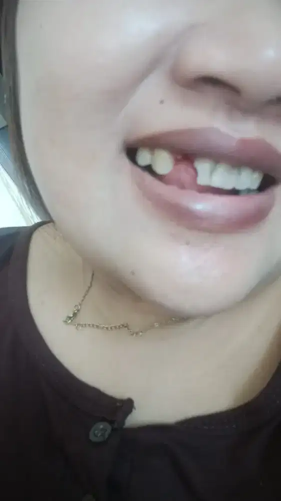 GIGI. PALSU BERKUALITASS