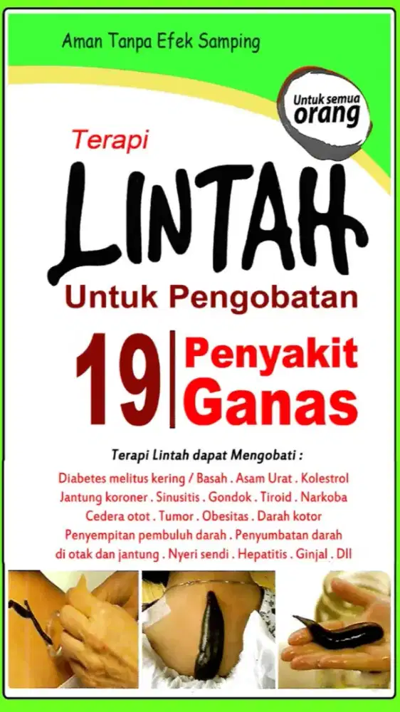 Terapi Lintah  Homecare