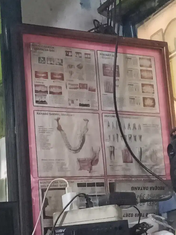 Jasa pasang gigi palsu