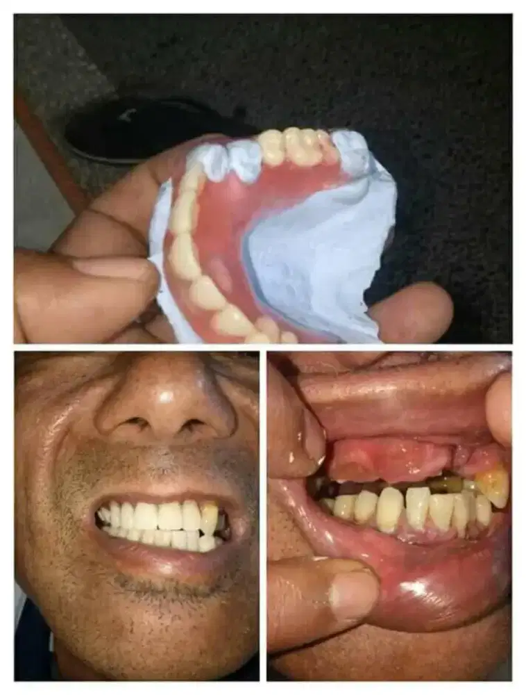 Pasang Gigi Bergaransi