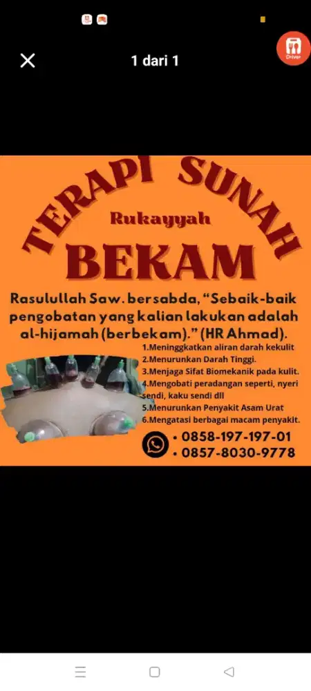Bekam basah dan kering