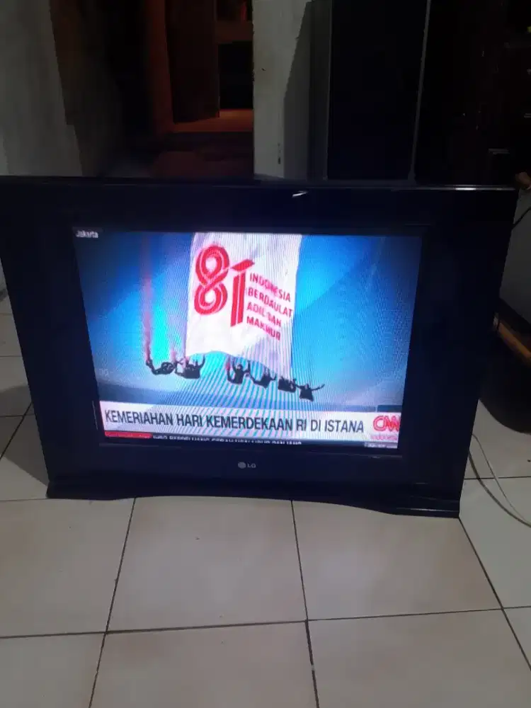 LG 29 in normal