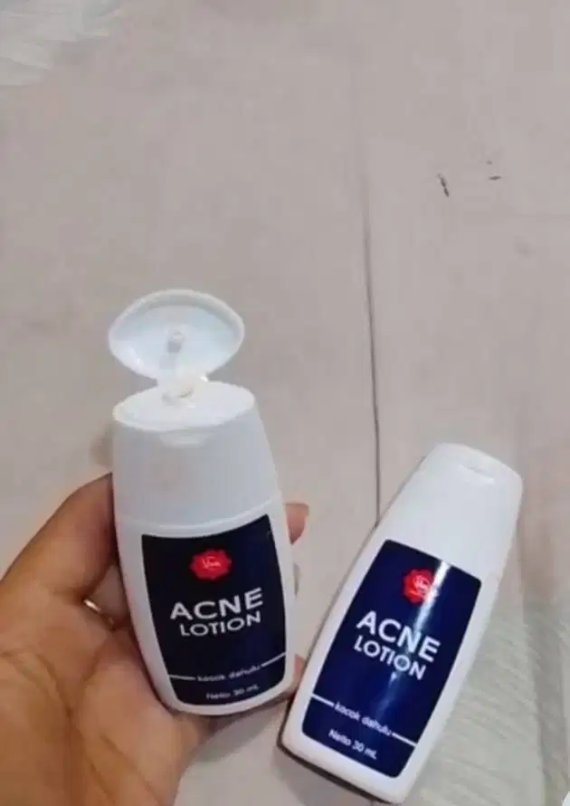 Viva acne sulfur lotion