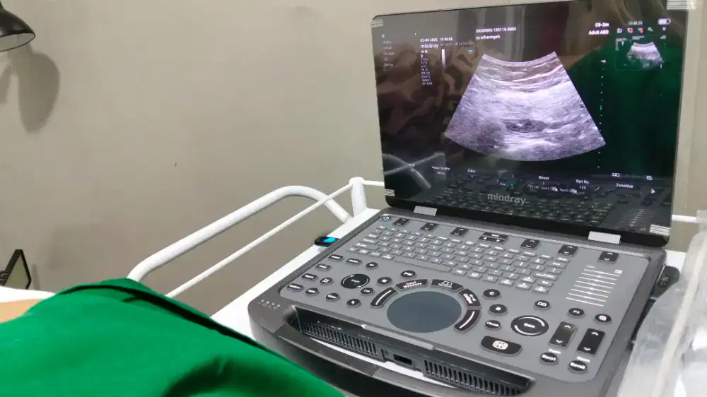 Ultrasound USG mindray seken
