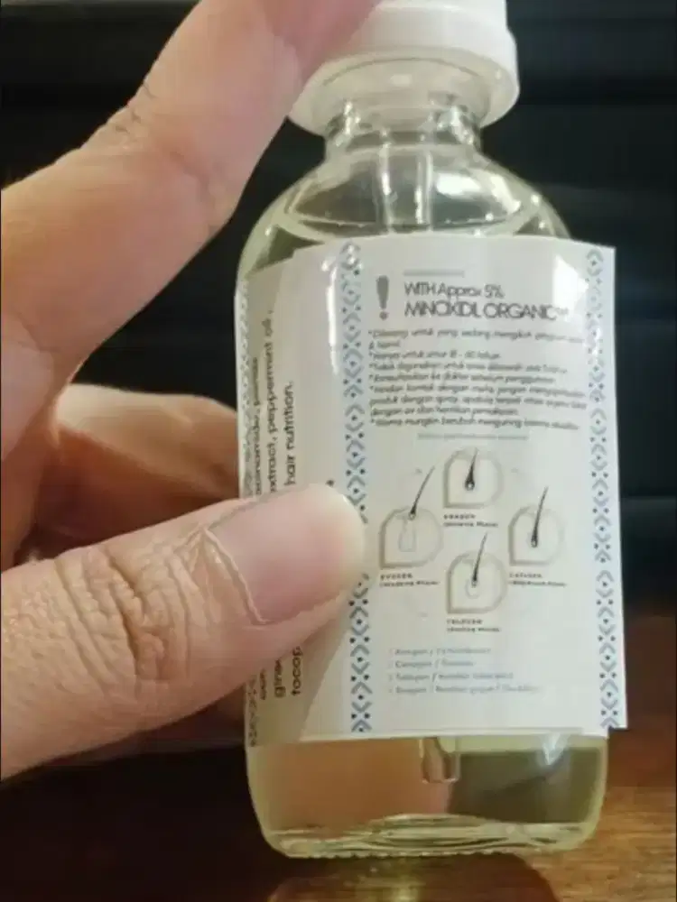 SOLUSI KEBOTAKAN RAMBUT MINOXIDIL 5%