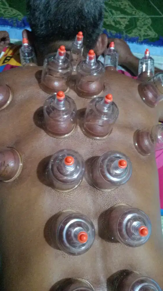 jasa bekam panggilan