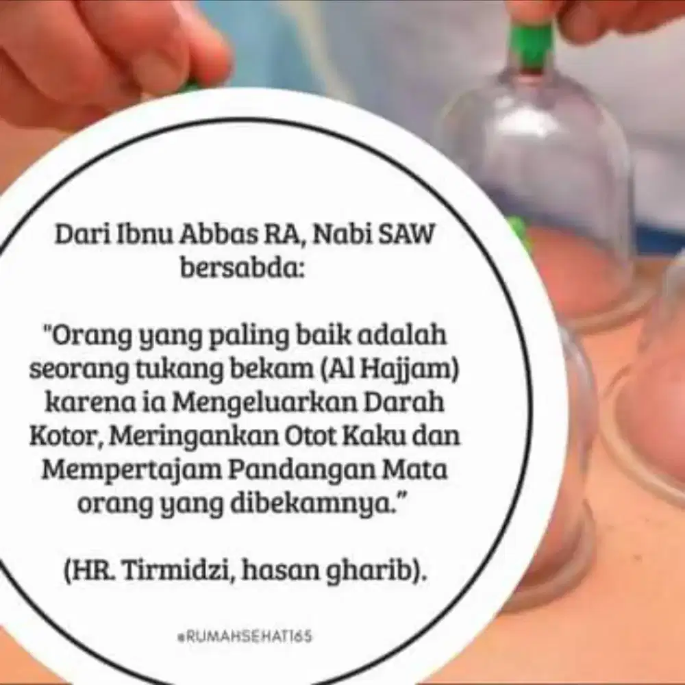 Jasa Bekam Sunnah Panggilan Bintaro Tangsel - Steril, Home Care 24 Jam