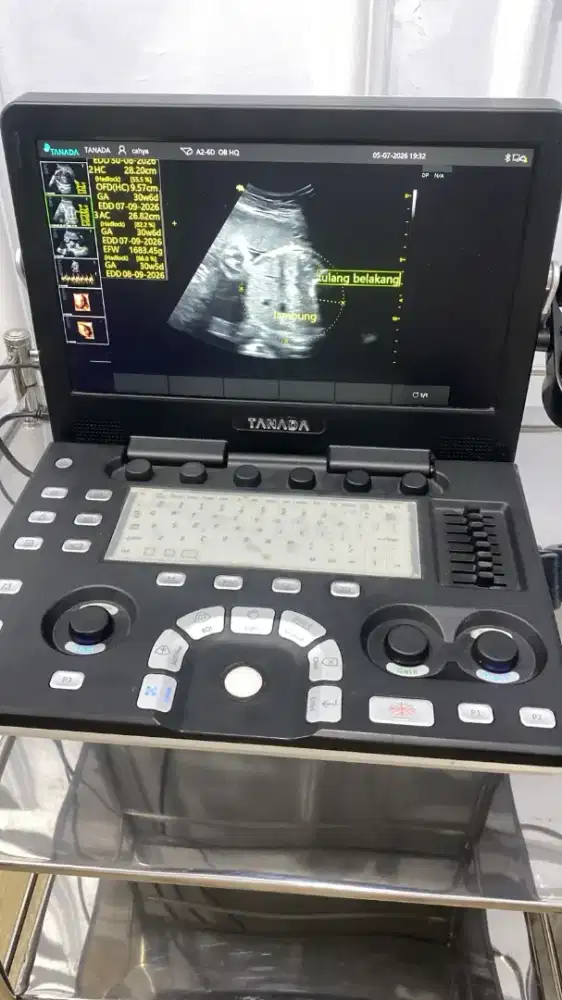 USG portable 3D/4D