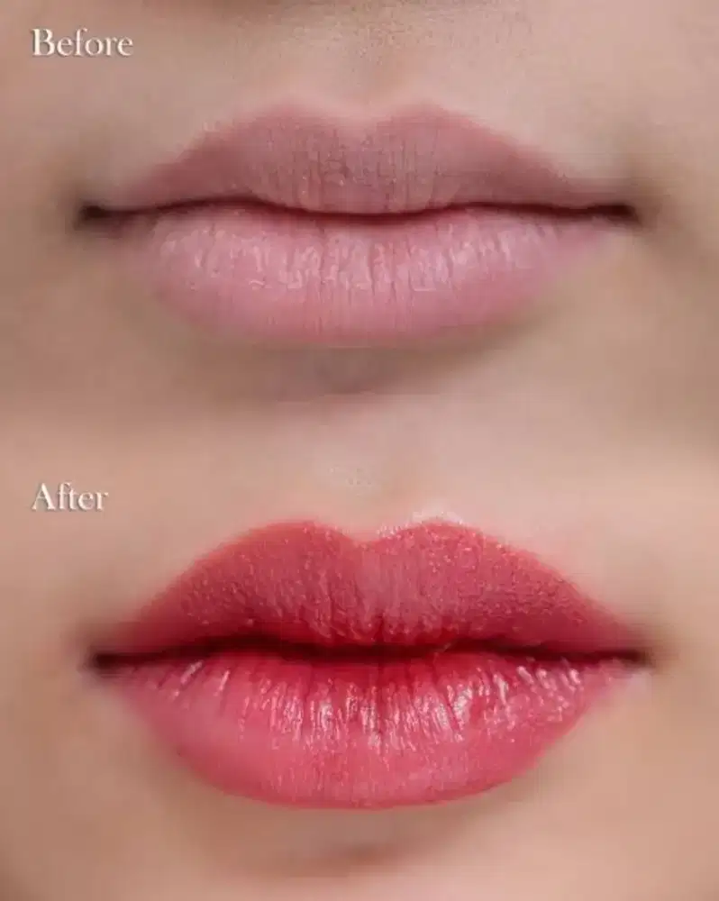 Dibutuhkan Model sulam Bibir yang Hitam atau Gelap atau Ungu boleh