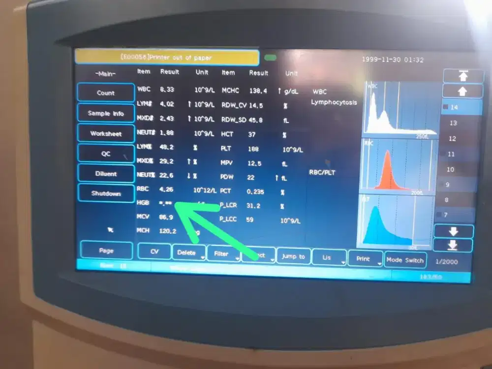 DIJUAL ALAT Hematology analyzer