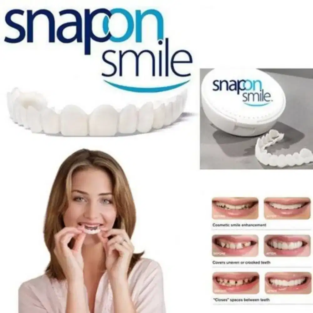 Snap On Smile( Gigi Palsu Silicon)