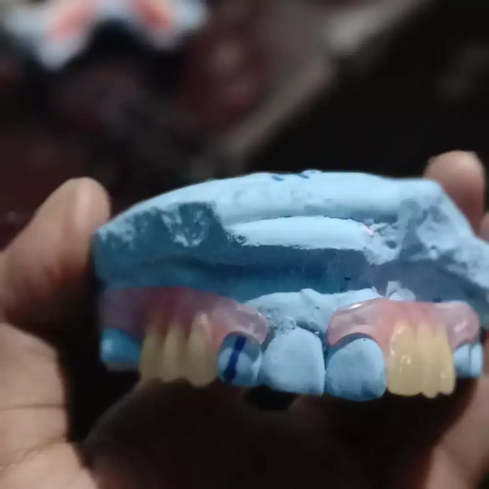 Behel dan gigi dll muarah