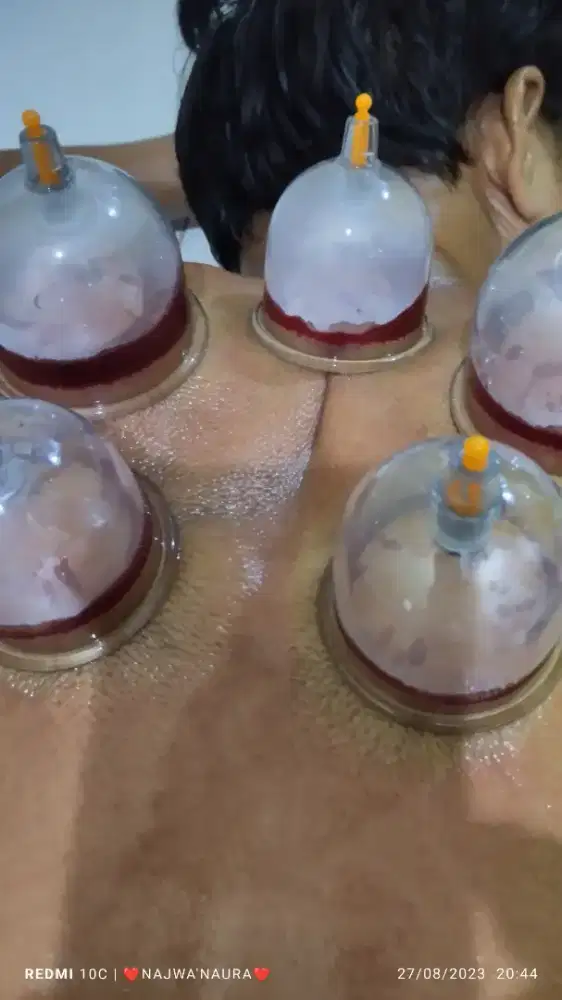 Terapis Sunnah Bekam