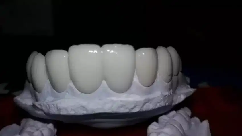 GIGI TIRUAN DAN TAMBAL GIGI PATAH