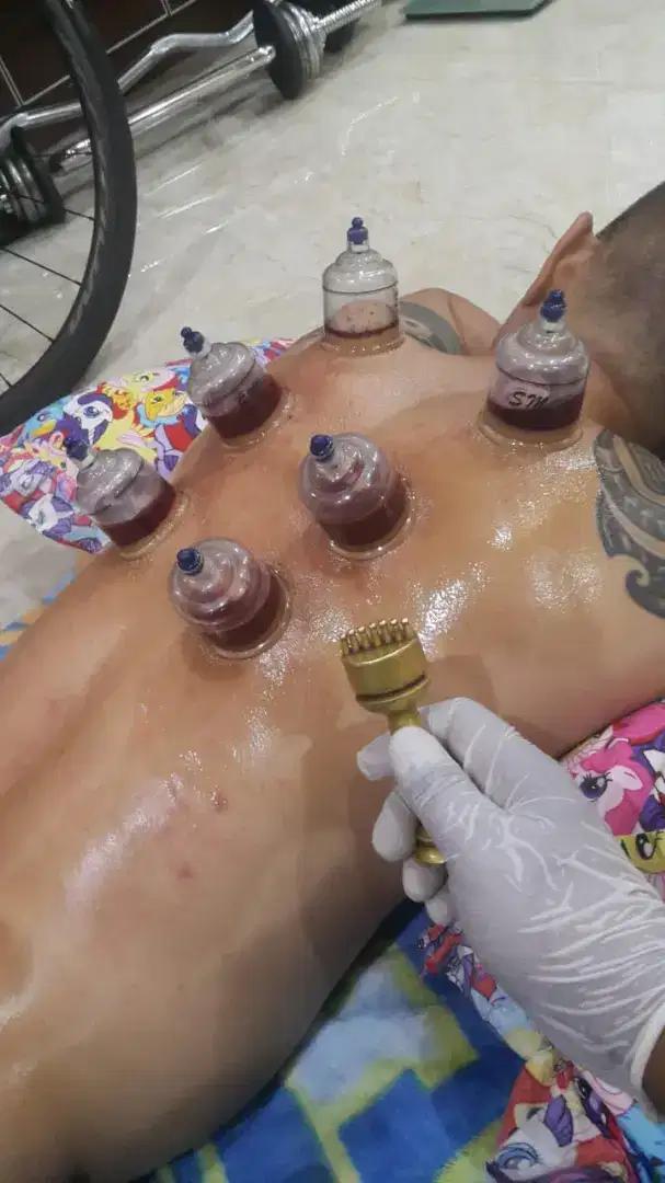 Rutin bekam per 3 minggu sudah pasang ring jantung