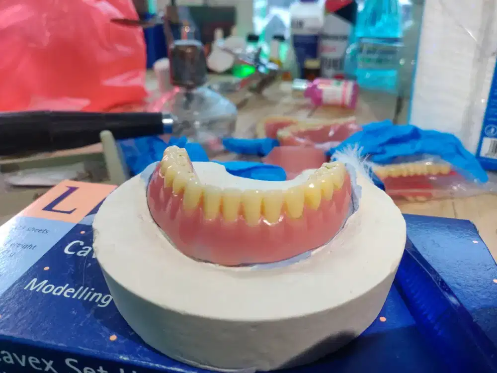 Alat bantu mengunyah