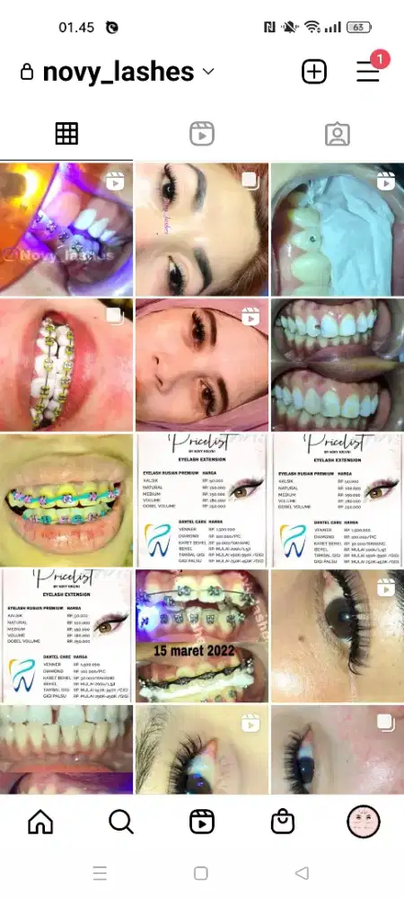 GIGI palsu/ PASANG GIGI