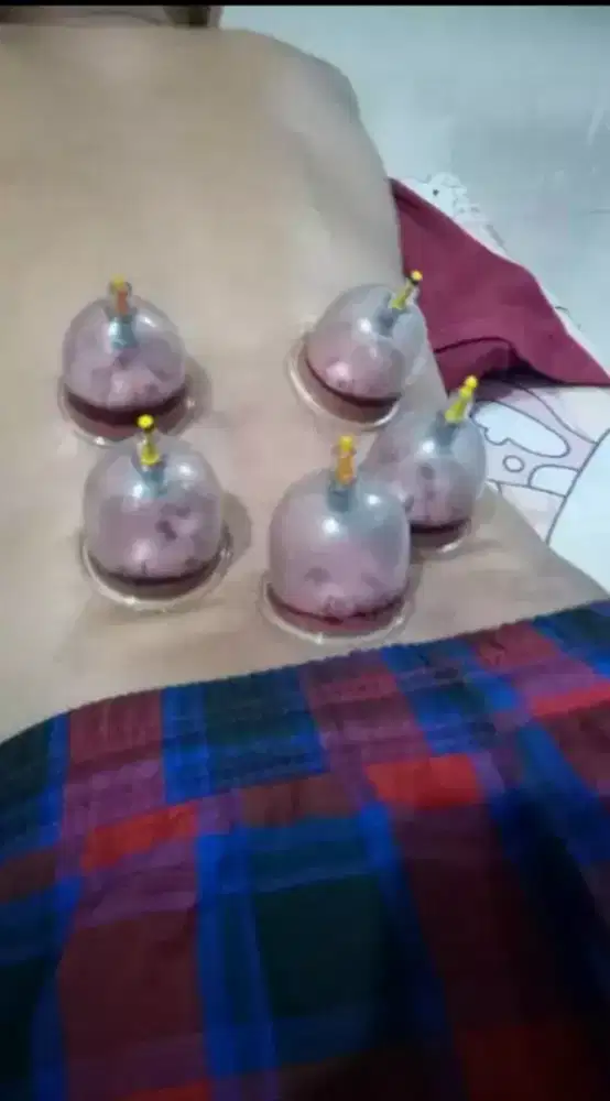 bekam terapi panggilan