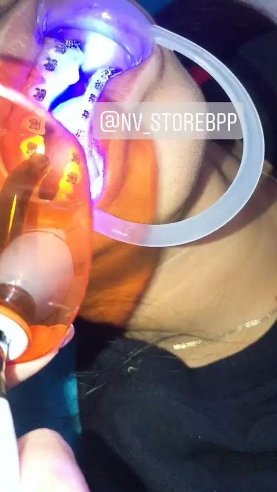 Pasang behel gigi permata