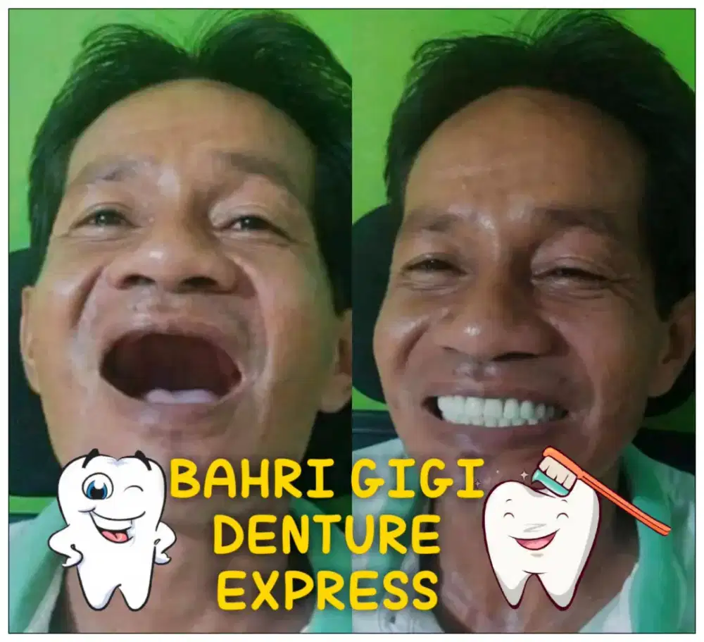Pasang gigi palsu terjangkau