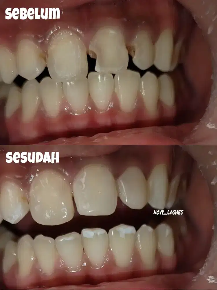 Ahli gigi / venner gigi palsu dll