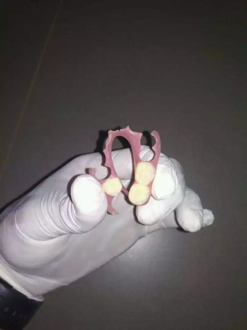 PASANG GIGI DAN TAMBAL GIGI KROPOS