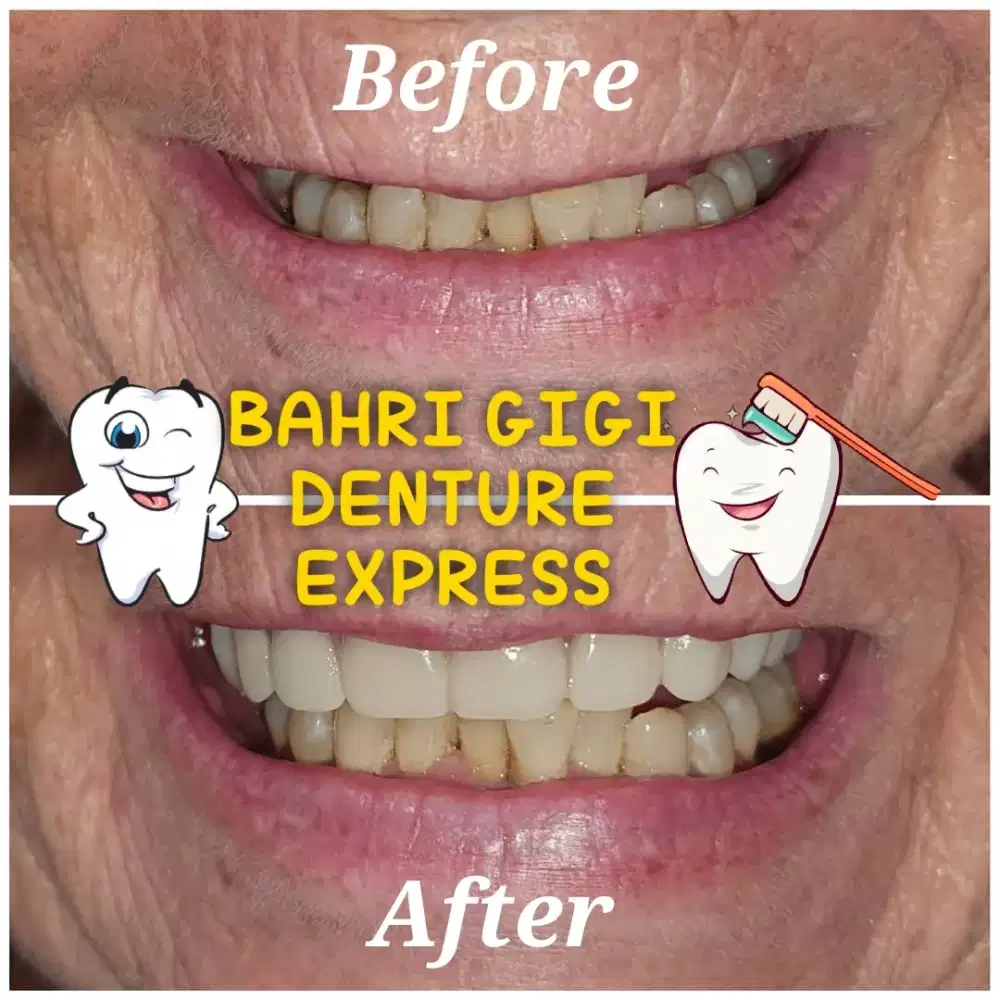 Pasang gigi palsu murah terjangkau