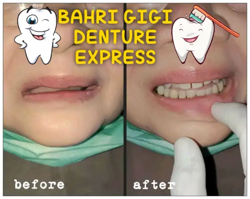 Pasang gigi palsu termurah