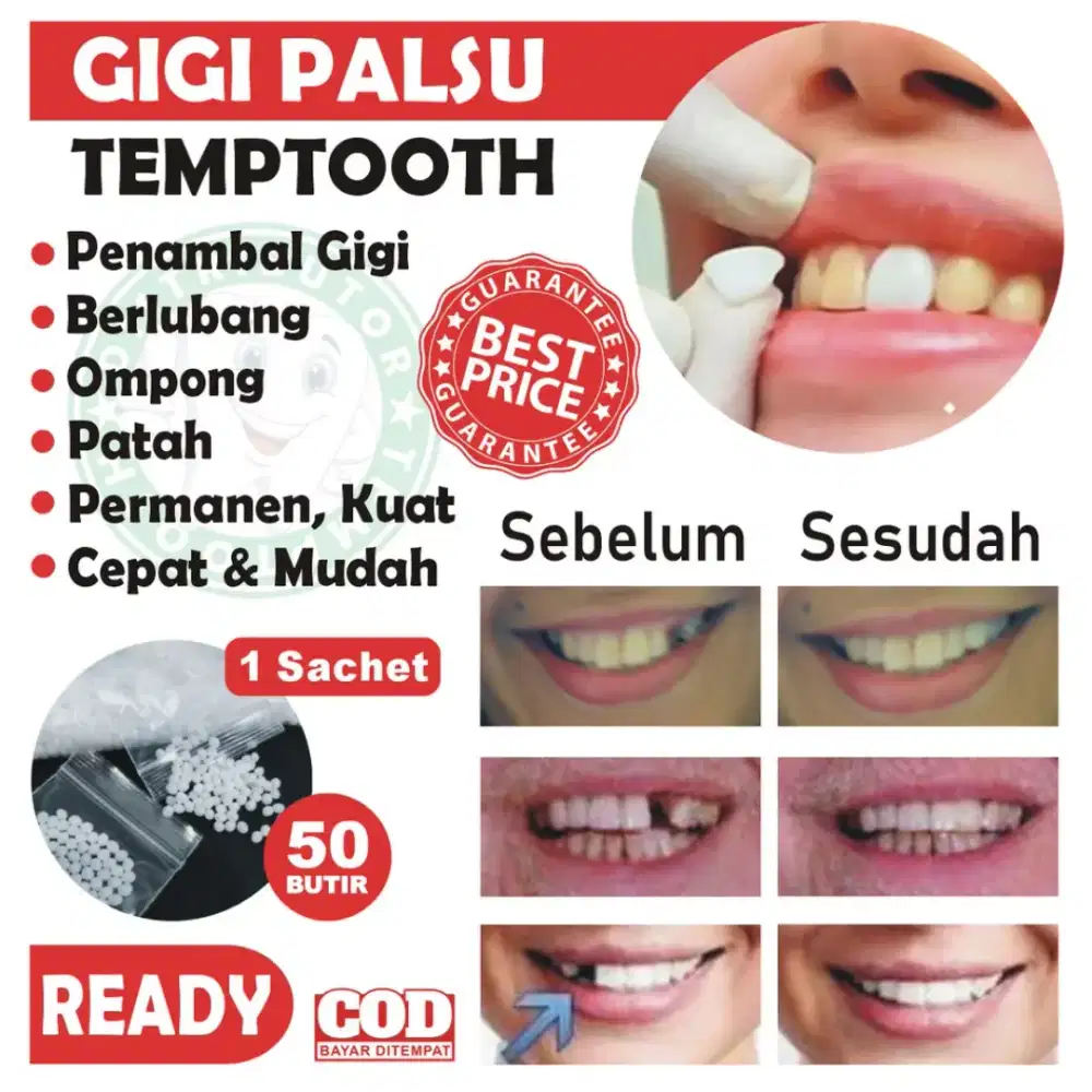 TAMBAL GIGI PATAH, GIGI BERLUBANG, DLL
