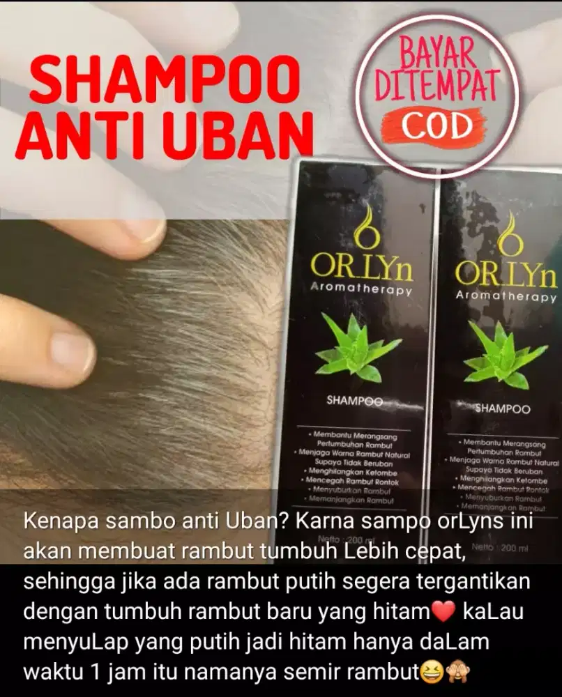 Shampo uban nasa surabaya