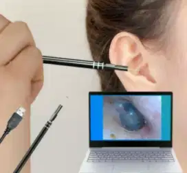 Kamera mulut hidung telinga bisa terhubung Android